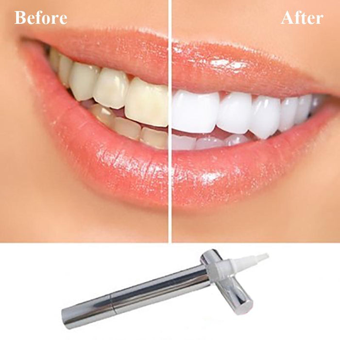 Instant Professional Teeth Whitening Pen - Free Shipping Today Only!